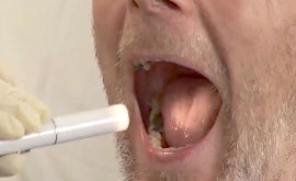 oralhygiene